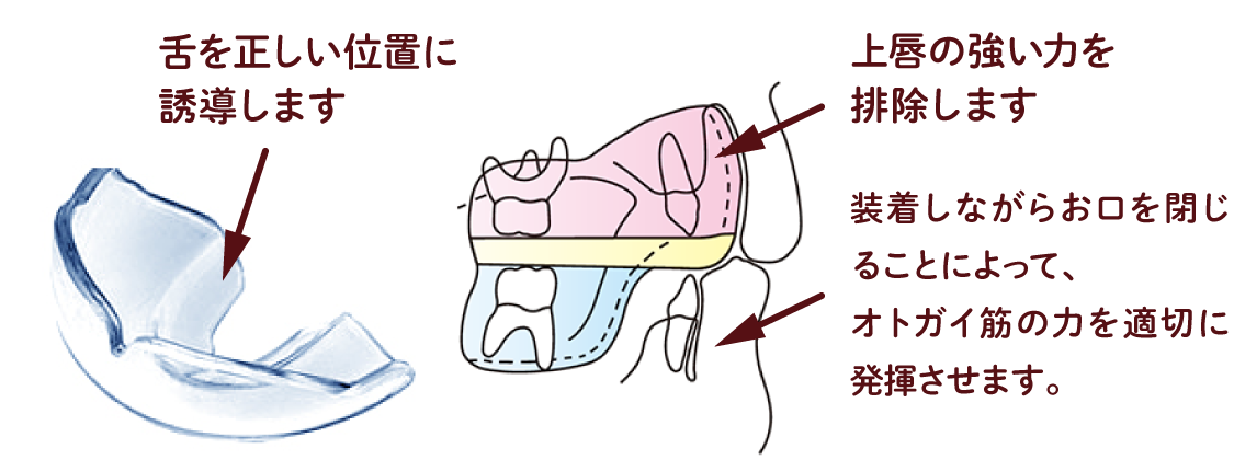 ムーシールド