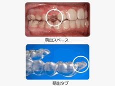 10代の歯列に対応