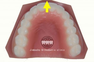 (ブログ) 「足りない隙間の作り方”5パターン”」IMG_0114ロゴ④前方拡大のコピー