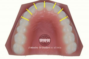 (ブログ) 「足りない隙間の作り方”5パターン”」IMG_0114ロゴ②IPRのコピー