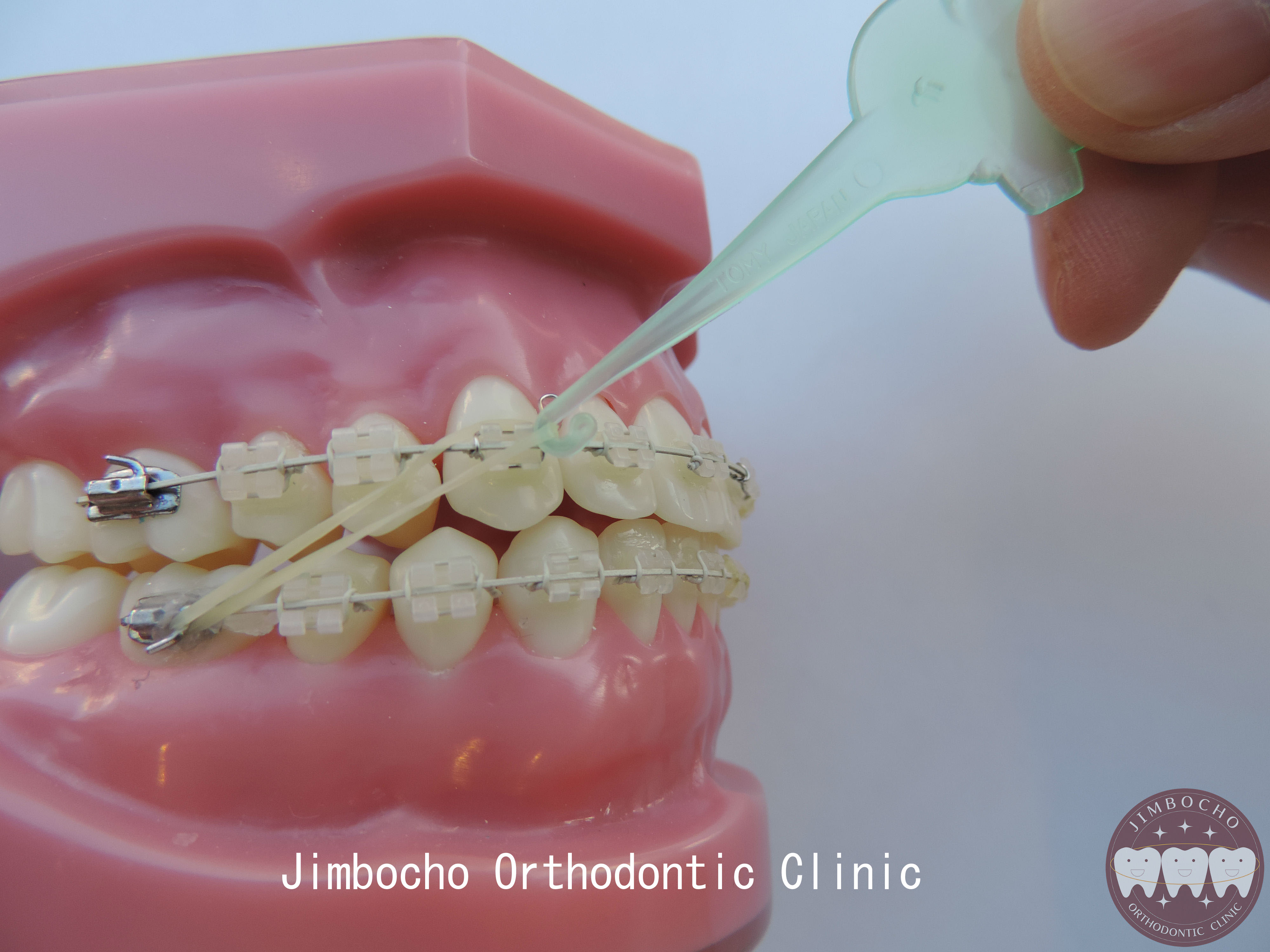 79％以上節約 歯科矯正 顎間ゴム ゴムかけ 歯並び エラスティック ワイヤー インビザライン