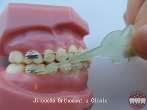 (ブログ) 「顎間ゴム用補助アイテム・エラスティックホルダー」DSCN0878ロゴ