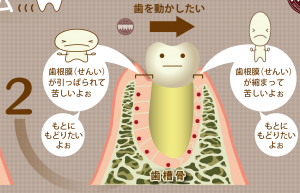 矯正治療で歯が動くメカニズム3ロゴ