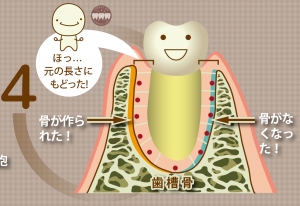 矯正治療で歯が動くメカニズム5ロゴ