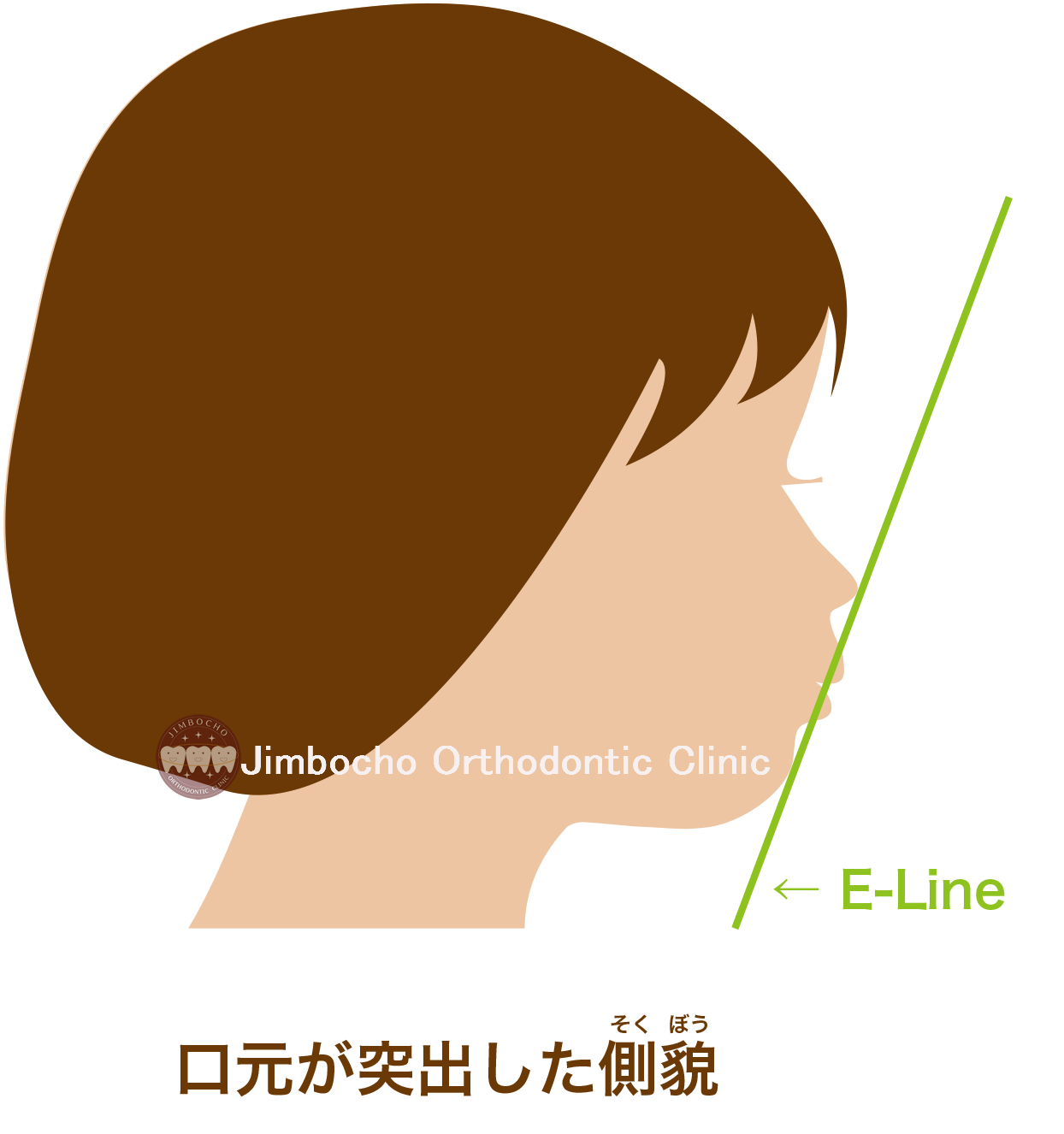 E Line イーライン エステティックライン 美しい口元の評価基準その１ 東京都千代田区の矯正歯科専門医院 神保町矯正歯科クリニック